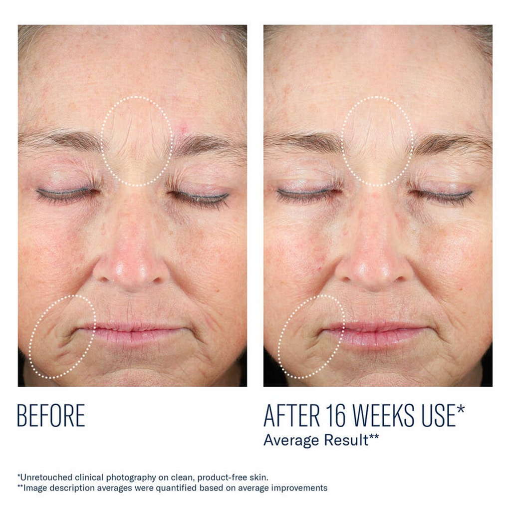 Skinbetter Science® Mystro Revive Renewing Serum 1.0 fl. oz. (30 ml)