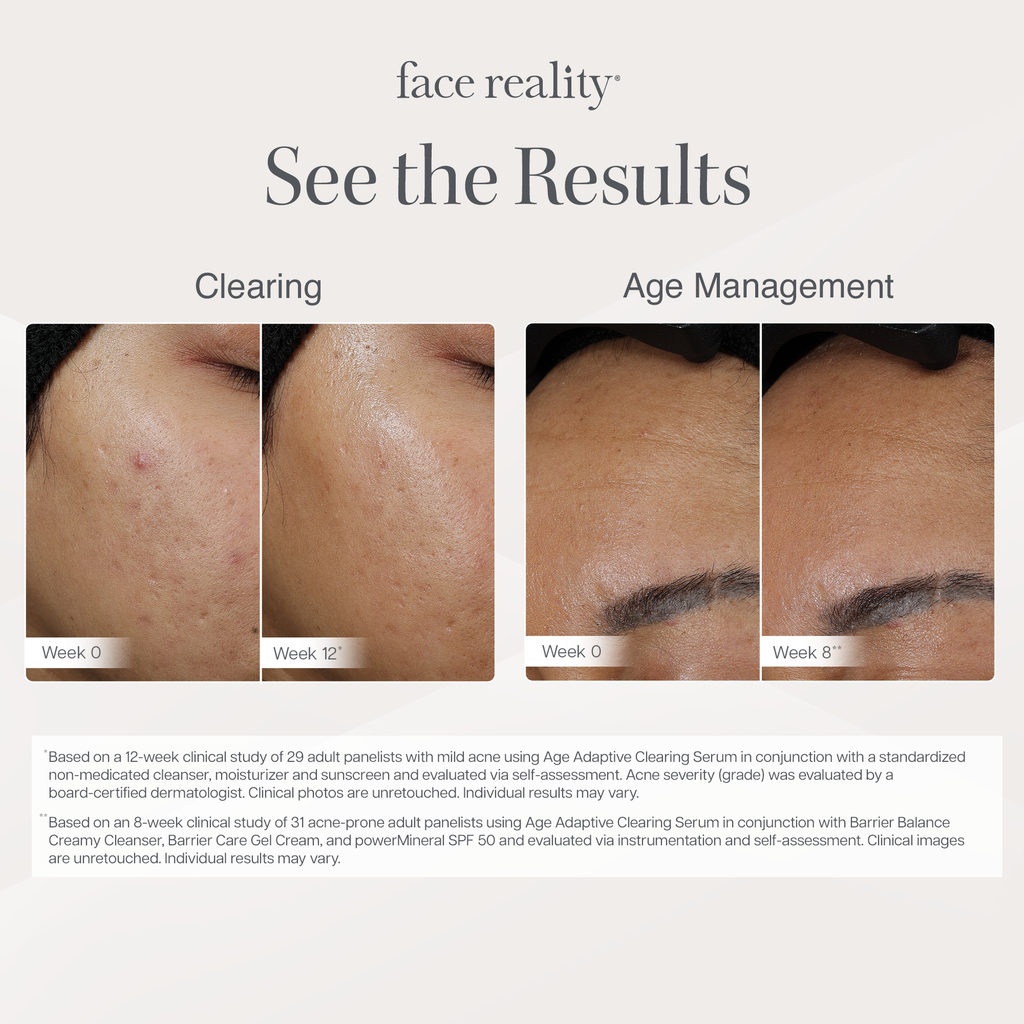 Age Adaptive Clearing Serum